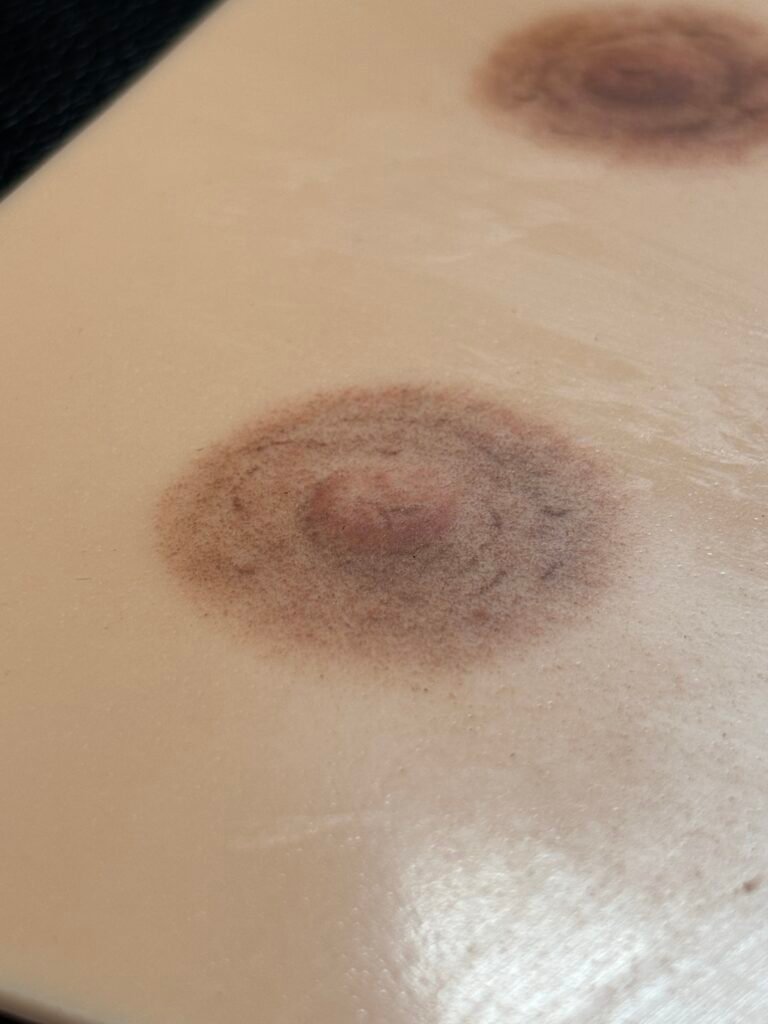 aréole mammaire silicone