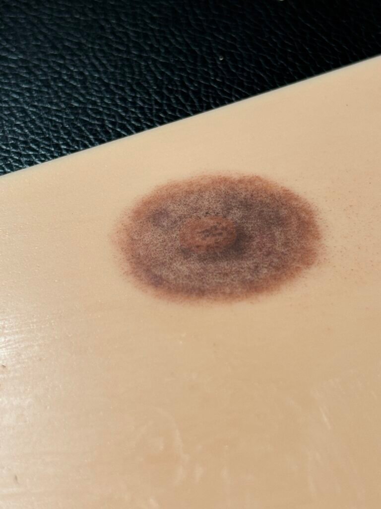 aréole mammaire silicone