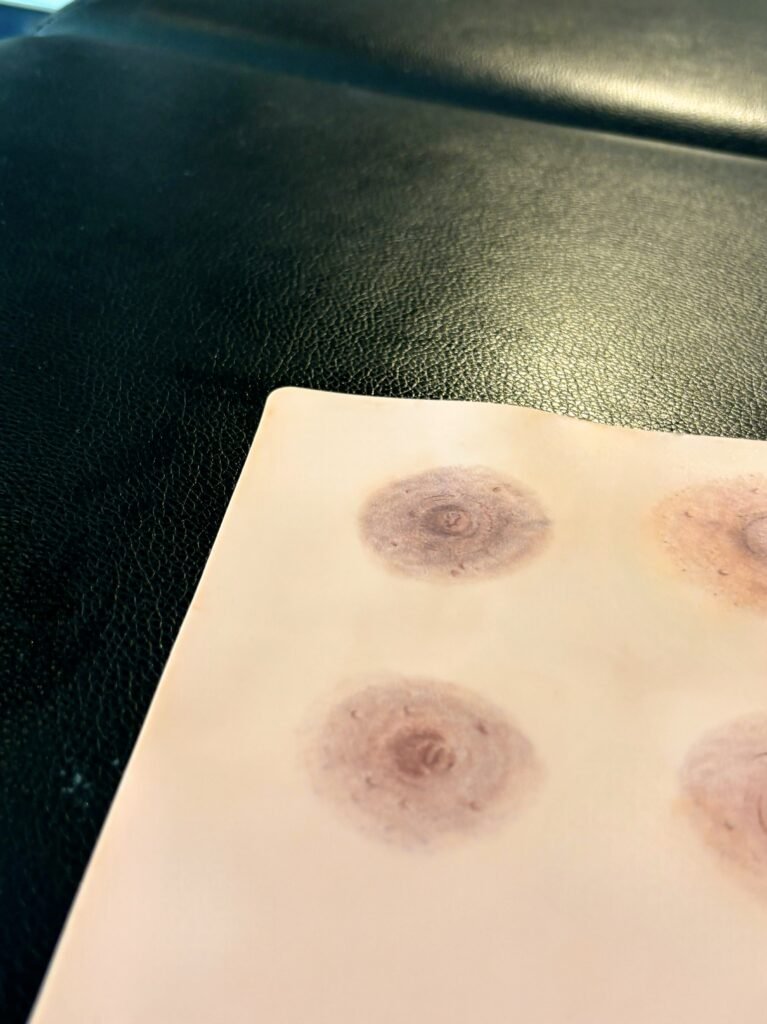 Aréole mammaire silicone